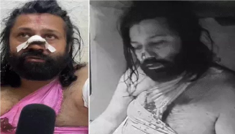 Ashutosh Maharaj Attack